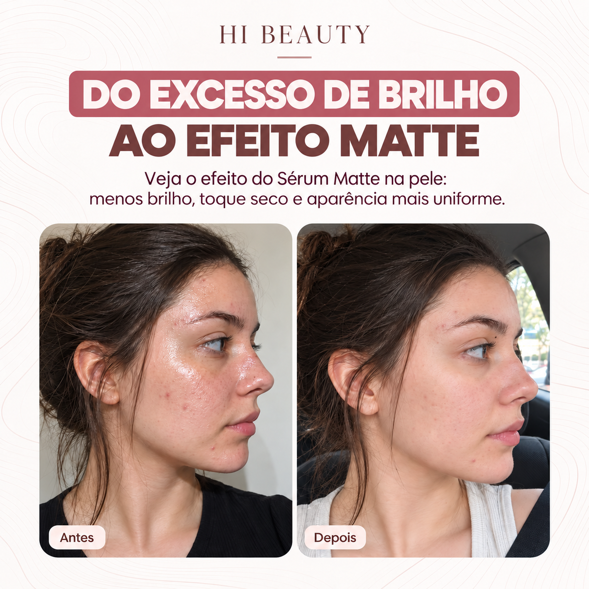 SÉRUM MATTE