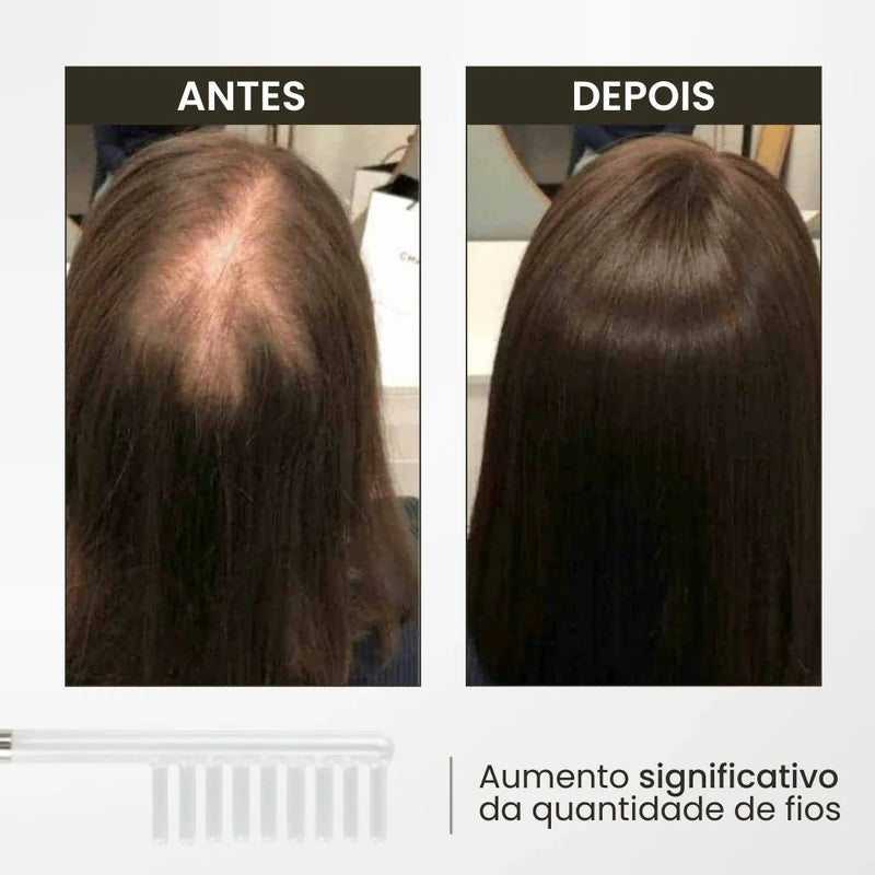 Escova de Alta Frequência: Inovação para Revitalização Capilar